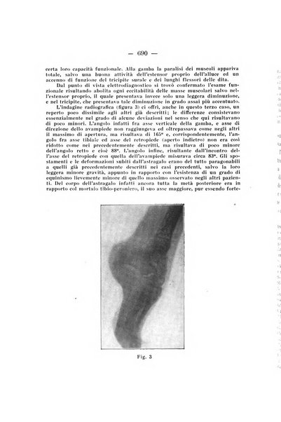 Archivio di ortopedia pubblicazione ufficiale del Pio istituto dei rachitici <1924-1950>