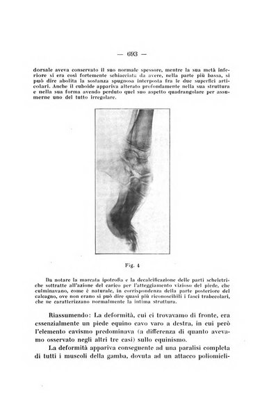 Archivio di ortopedia pubblicazione ufficiale del Pio istituto dei rachitici <1924-1950>