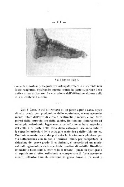 Archivio di ortopedia pubblicazione ufficiale del Pio istituto dei rachitici <1924-1950>