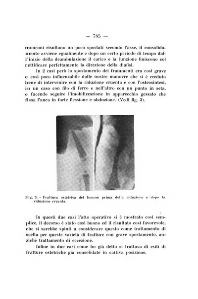 Archivio di ortopedia pubblicazione ufficiale del Pio istituto dei rachitici <1924-1950>