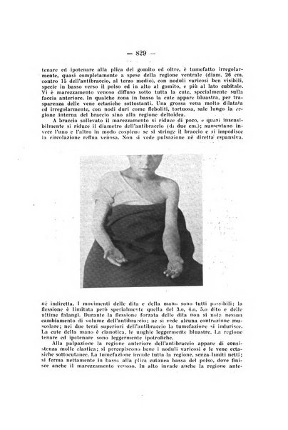 Archivio di ortopedia pubblicazione ufficiale del Pio istituto dei rachitici <1924-1950>