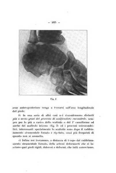 Archivio di ortopedia pubblicazione ufficiale del Pio istituto dei rachitici <1924-1950>