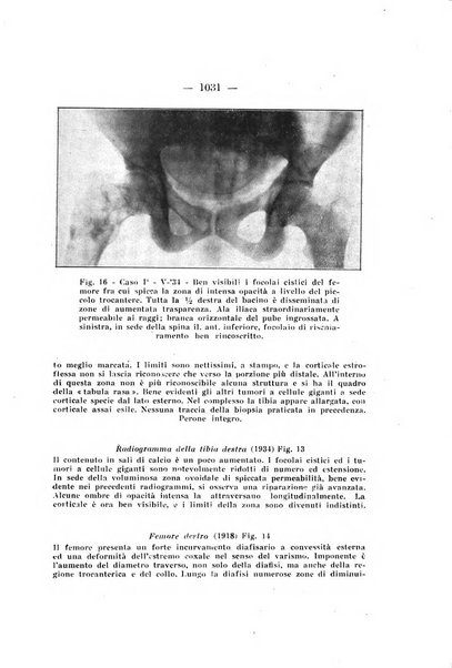 Archivio di ortopedia pubblicazione ufficiale del Pio istituto dei rachitici <1924-1950>