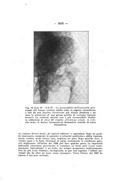 Archivio di ortopedia pubblicazione ufficiale del Pio istituto dei rachitici <1924-1950>