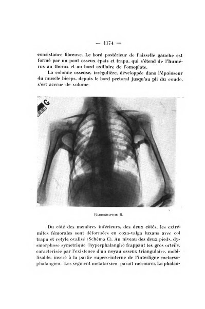 Archivio di ortopedia pubblicazione ufficiale del Pio istituto dei rachitici <1924-1950>