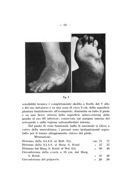 Archivio di ortopedia pubblicazione ufficiale del Pio istituto dei rachitici <1924-1950>