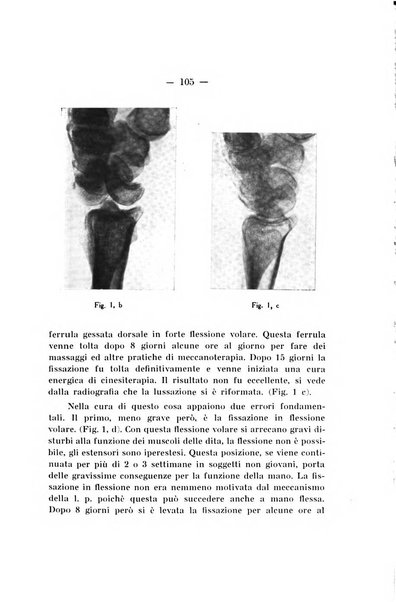 Archivio di ortopedia pubblicazione ufficiale del Pio istituto dei rachitici <1924-1950>