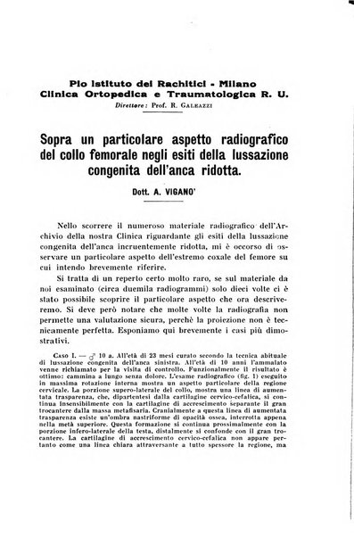 Archivio di ortopedia pubblicazione ufficiale del Pio istituto dei rachitici <1924-1950>