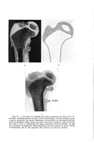 Archivio di ortopedia pubblicazione ufficiale del Pio istituto dei rachitici <1924-1950>