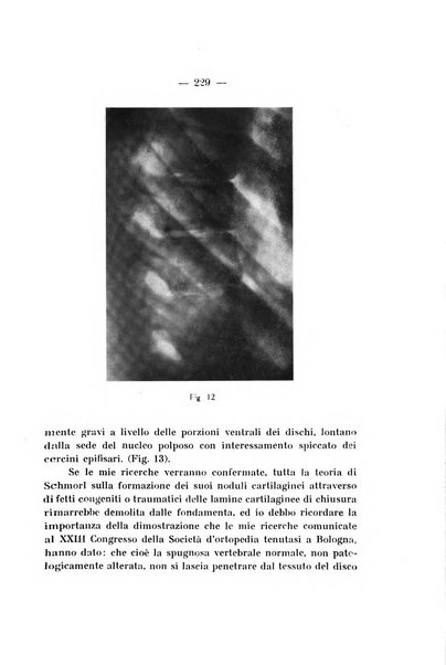 Archivio di ortopedia pubblicazione ufficiale del Pio istituto dei rachitici <1924-1950>