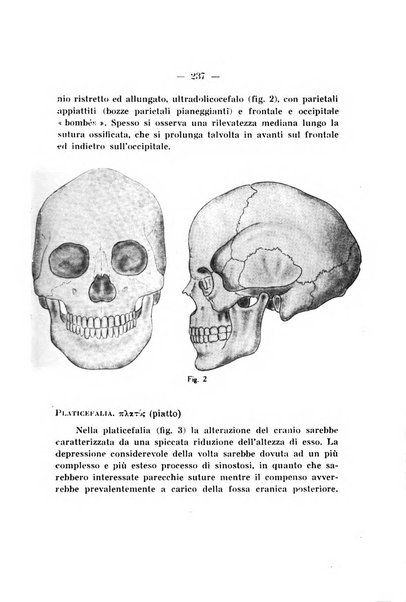 Archivio di ortopedia pubblicazione ufficiale del Pio istituto dei rachitici <1924-1950>