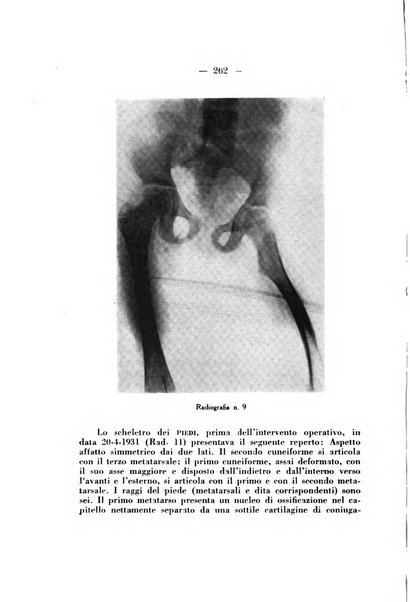 Archivio di ortopedia pubblicazione ufficiale del Pio istituto dei rachitici <1924-1950>