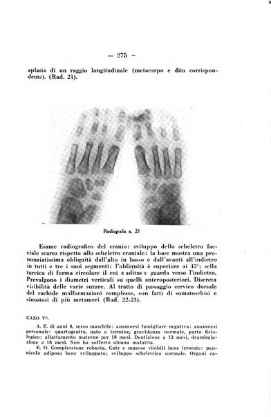 Archivio di ortopedia pubblicazione ufficiale del Pio istituto dei rachitici <1924-1950>