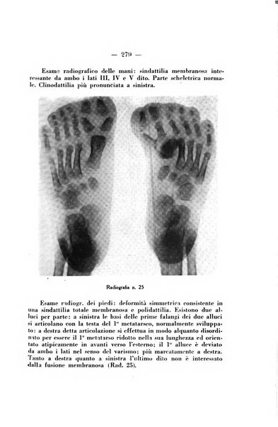 Archivio di ortopedia pubblicazione ufficiale del Pio istituto dei rachitici <1924-1950>