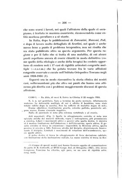 Archivio di ortopedia pubblicazione ufficiale del Pio istituto dei rachitici <1924-1950>