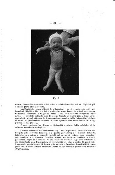 Archivio di ortopedia pubblicazione ufficiale del Pio istituto dei rachitici <1924-1950>