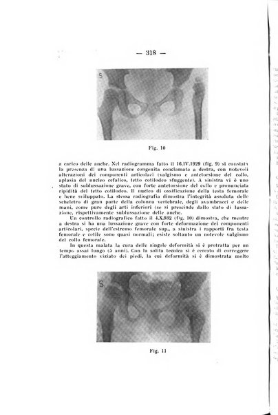 Archivio di ortopedia pubblicazione ufficiale del Pio istituto dei rachitici <1924-1950>