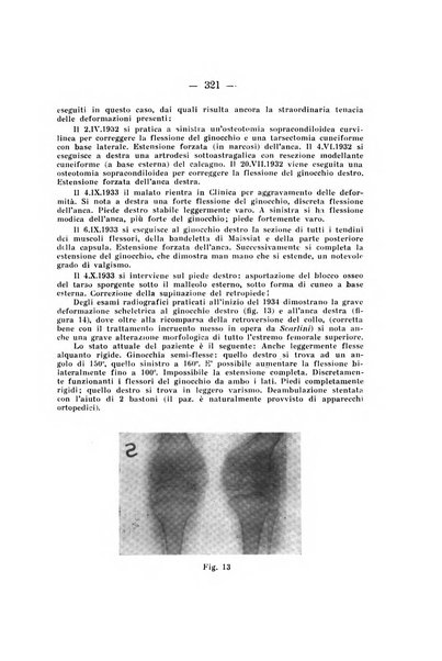 Archivio di ortopedia pubblicazione ufficiale del Pio istituto dei rachitici <1924-1950>