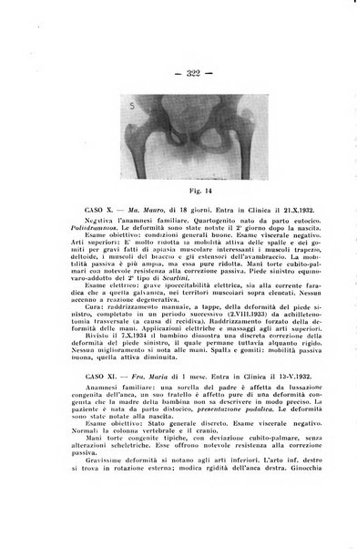 Archivio di ortopedia pubblicazione ufficiale del Pio istituto dei rachitici <1924-1950>