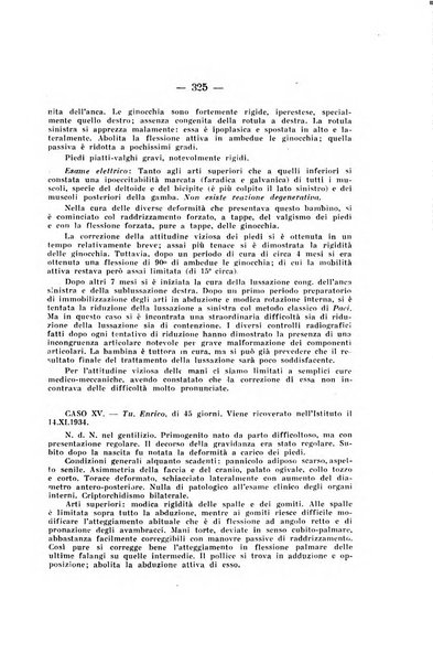 Archivio di ortopedia pubblicazione ufficiale del Pio istituto dei rachitici <1924-1950>