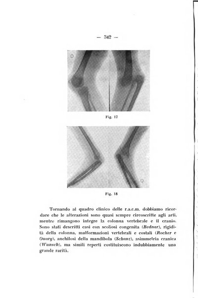 Archivio di ortopedia pubblicazione ufficiale del Pio istituto dei rachitici <1924-1950>