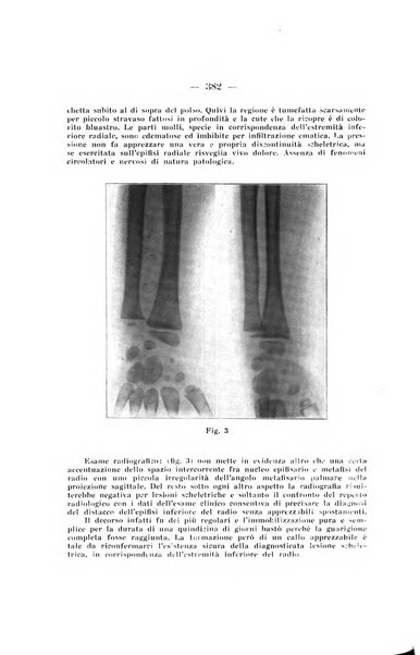 Archivio di ortopedia pubblicazione ufficiale del Pio istituto dei rachitici <1924-1950>