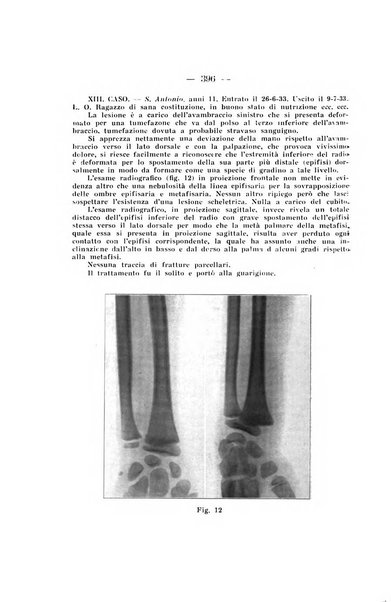 Archivio di ortopedia pubblicazione ufficiale del Pio istituto dei rachitici <1924-1950>