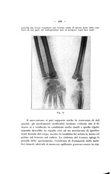 Archivio di ortopedia pubblicazione ufficiale del Pio istituto dei rachitici <1924-1950>