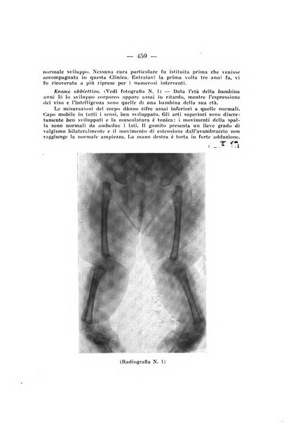 Archivio di ortopedia pubblicazione ufficiale del Pio istituto dei rachitici <1924-1950>