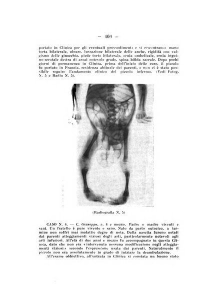 Archivio di ortopedia pubblicazione ufficiale del Pio istituto dei rachitici <1924-1950>