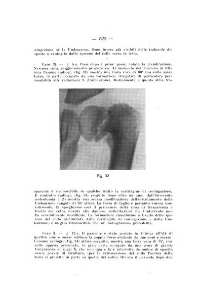 Archivio di ortopedia pubblicazione ufficiale del Pio istituto dei rachitici <1924-1950>