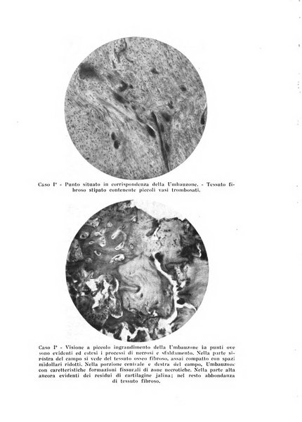 Archivio di ortopedia pubblicazione ufficiale del Pio istituto dei rachitici <1924-1950>