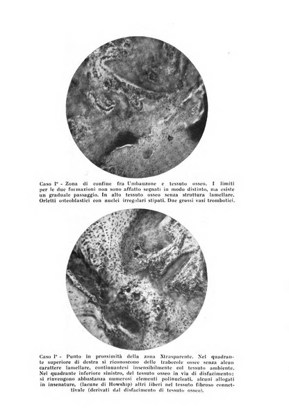 Archivio di ortopedia pubblicazione ufficiale del Pio istituto dei rachitici <1924-1950>