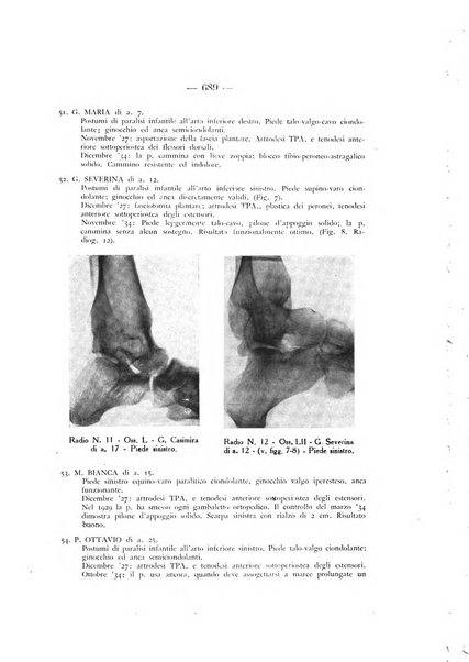 Archivio di ortopedia pubblicazione ufficiale del Pio istituto dei rachitici <1924-1950>