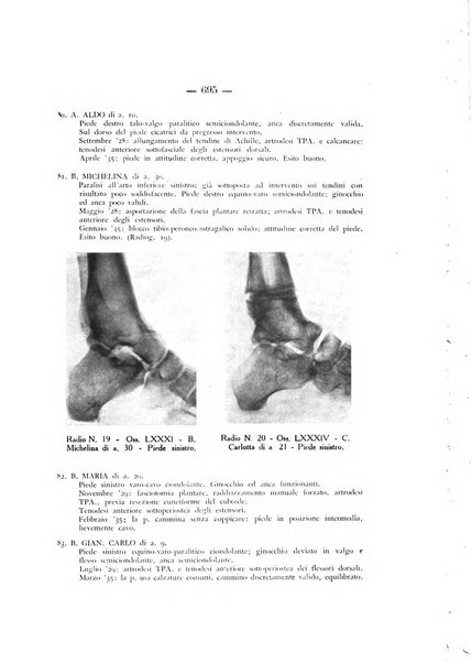 Archivio di ortopedia pubblicazione ufficiale del Pio istituto dei rachitici <1924-1950>