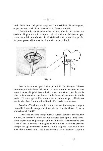 Archivio di ortopedia pubblicazione ufficiale del Pio istituto dei rachitici <1924-1950>