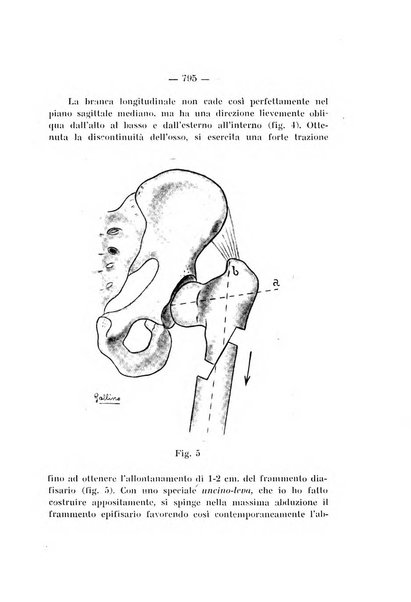 Archivio di ortopedia pubblicazione ufficiale del Pio istituto dei rachitici <1924-1950>