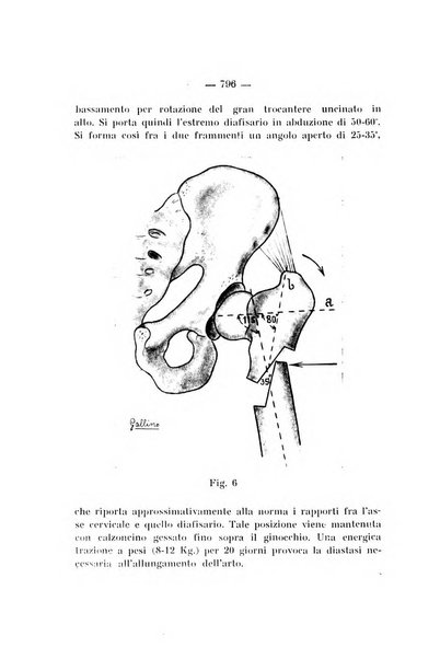 Archivio di ortopedia pubblicazione ufficiale del Pio istituto dei rachitici <1924-1950>