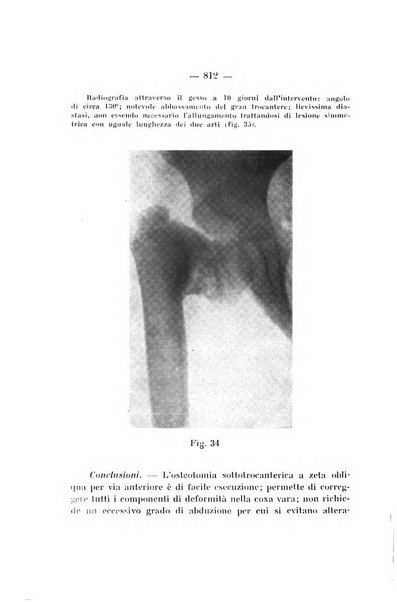 Archivio di ortopedia pubblicazione ufficiale del Pio istituto dei rachitici <1924-1950>