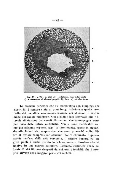 Archivio di ortopedia pubblicazione ufficiale del Pio istituto dei rachitici <1924-1950>