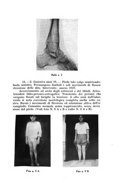 Archivio di ortopedia pubblicazione ufficiale del Pio istituto dei rachitici <1924-1950>