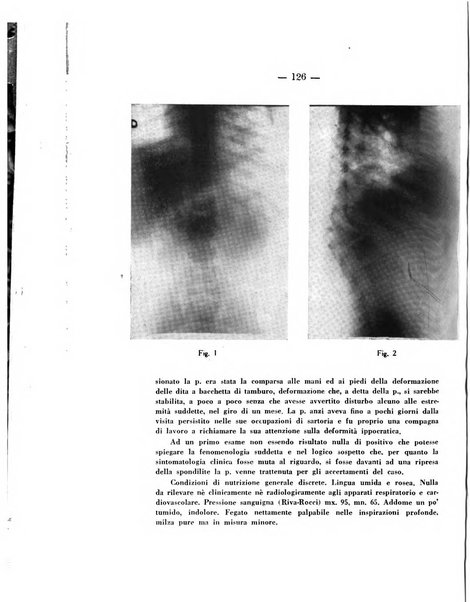 Archivio di ortopedia pubblicazione ufficiale del Pio istituto dei rachitici <1924-1950>