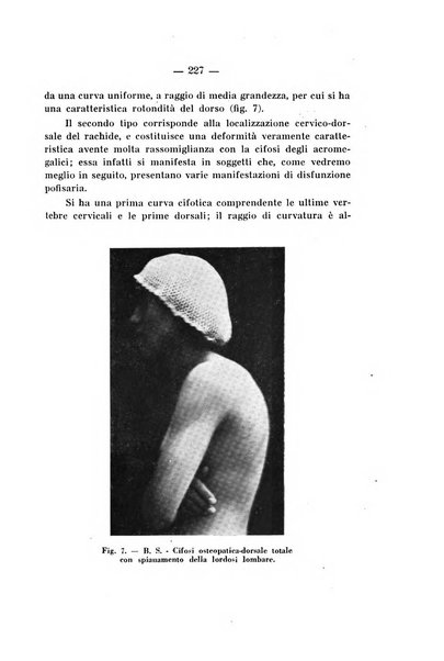 Archivio di ortopedia pubblicazione ufficiale del Pio istituto dei rachitici <1924-1950>