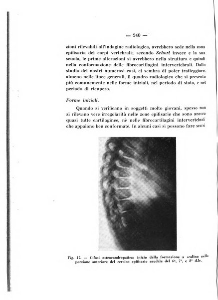 Archivio di ortopedia pubblicazione ufficiale del Pio istituto dei rachitici <1924-1950>