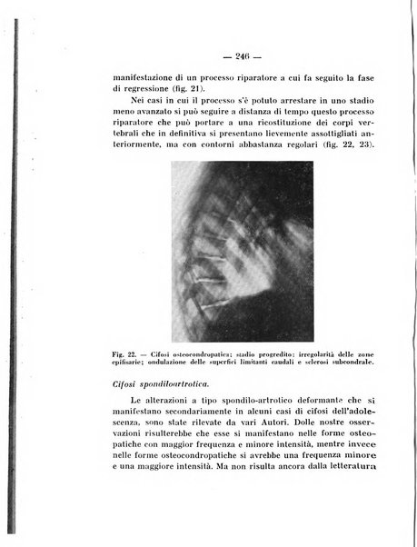 Archivio di ortopedia pubblicazione ufficiale del Pio istituto dei rachitici <1924-1950>