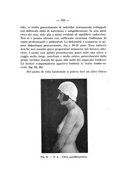 Archivio di ortopedia pubblicazione ufficiale del Pio istituto dei rachitici <1924-1950>