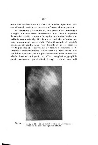 Archivio di ortopedia pubblicazione ufficiale del Pio istituto dei rachitici <1924-1950>