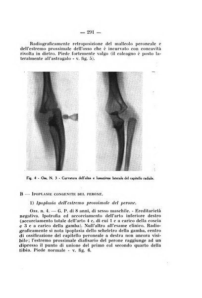 Archivio di ortopedia pubblicazione ufficiale del Pio istituto dei rachitici <1924-1950>