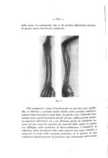 Archivio di ortopedia pubblicazione ufficiale del Pio istituto dei rachitici <1924-1950>