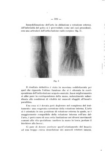 Archivio di ortopedia pubblicazione ufficiale del Pio istituto dei rachitici <1924-1950>